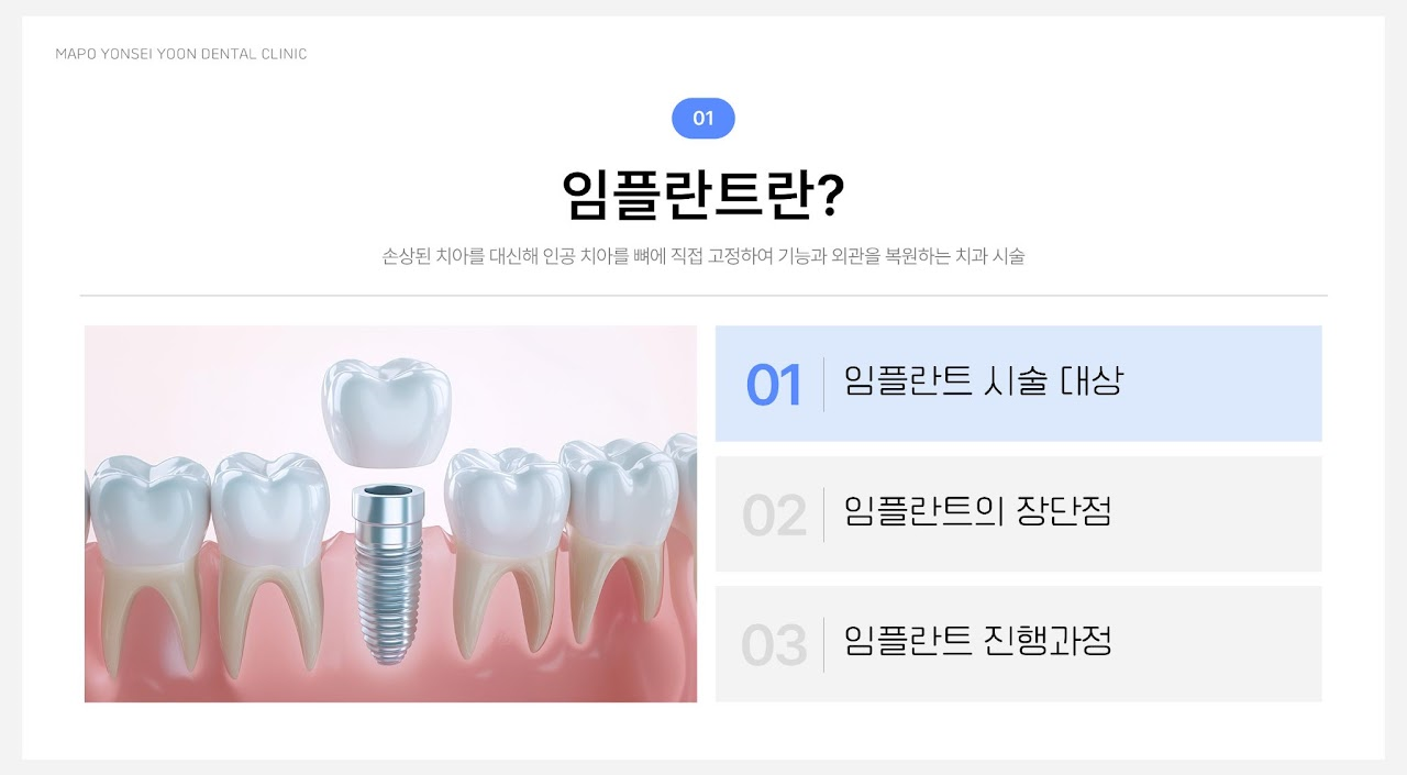 임플란트 1