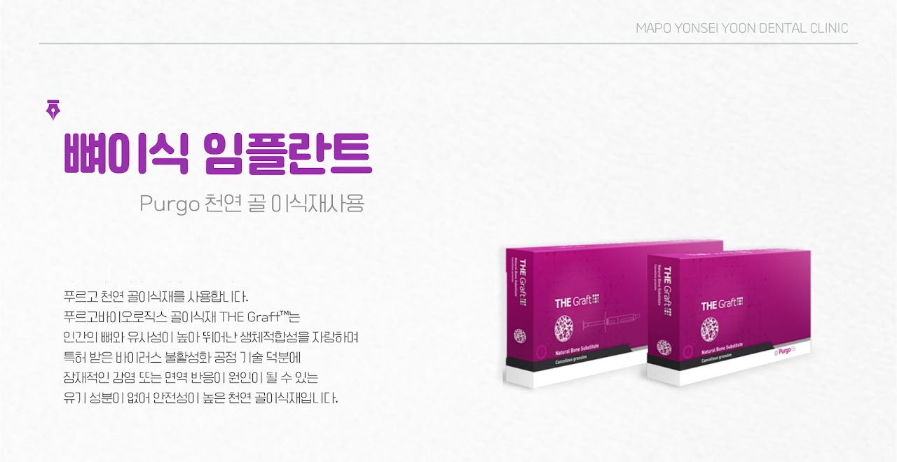 임플란트 6