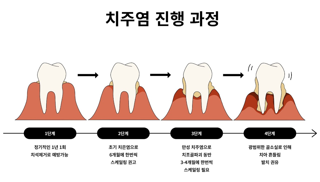 잇몸 2