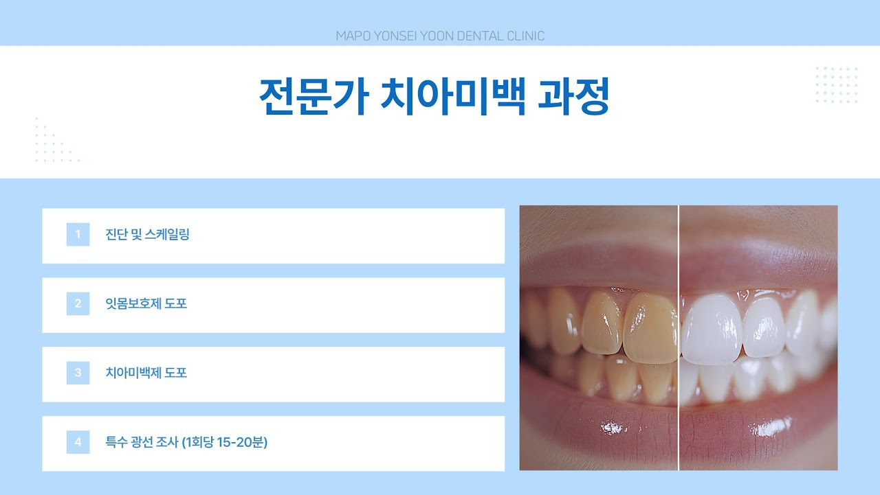 미백 4
